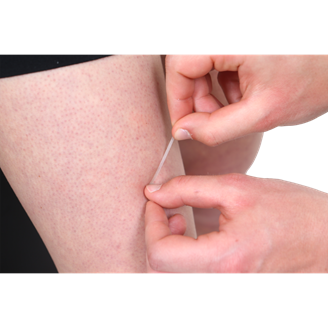 Image sur Lot de 5 sutures - Bandelettes Stériles